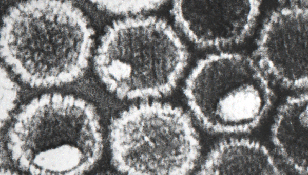 A section of a negatively-stained transmission electron micrograph (TEM) revealed the presence of numerous herpes simplex virions, members of the Herpesviridae virus family. There are two strains of the herpes simplex virus, HSV-1, which is responsible for cold sores, and HSV-2, which is responsible for genital herpes. Credit: CDC/ Dr. Fred Murphy; Sylvia Whitfield
